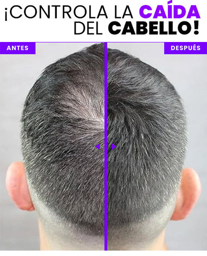 ⭐️ MEGA PROMO ⭐️ BUNEE FIBRA CAPILAR: Cobertura Instantánea para Canas, Entradas, Cejas, Barba y Zonas Claras